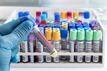 Blood draw tubes as part of the our Boise, Garden City, Meridian, Nampa, Idaho Falls, Pocatello and Rexburg area Employee Wellness program.