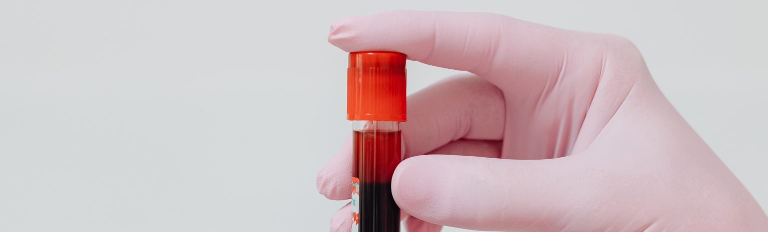 Gloved worker with blood sample in vile. Phlebotomy classes for medical laboratory services provided in Boise, Garden City, Meridian, Nampa, Idaho Falls, Pocatello and Rexburg
